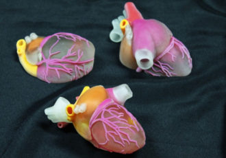 3D-gedruckte chirurgische Modelle