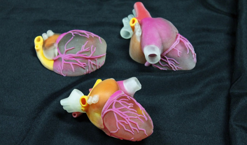 3D-gedruckte chirurgische Modelle