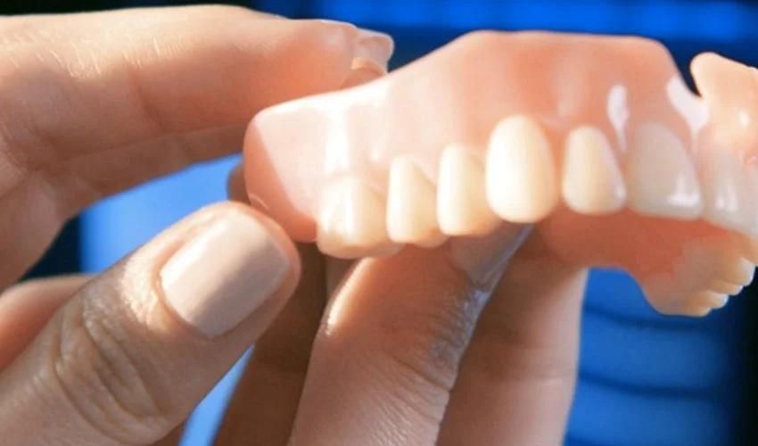 3D-gedruckte Zahnspange