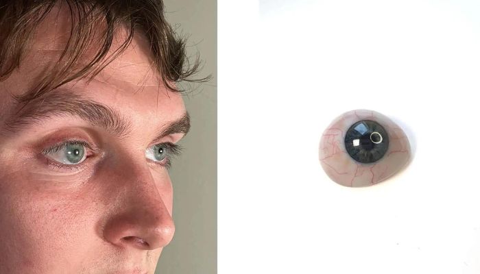 3D-Druck Augenheilkunde