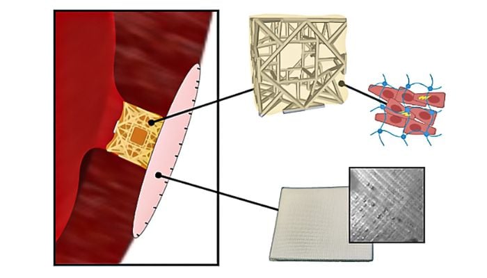 A schematic diagram showing how the patch is applied