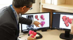 3D-Modell des Uterus