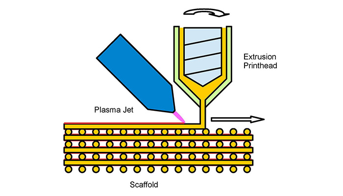 3D-gedruckte Knochenimplantate