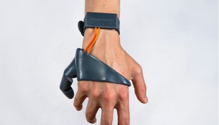 3D-gedruckte Prothesen