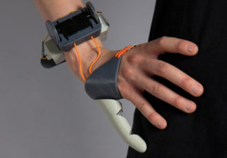 Prothese 3D Druck