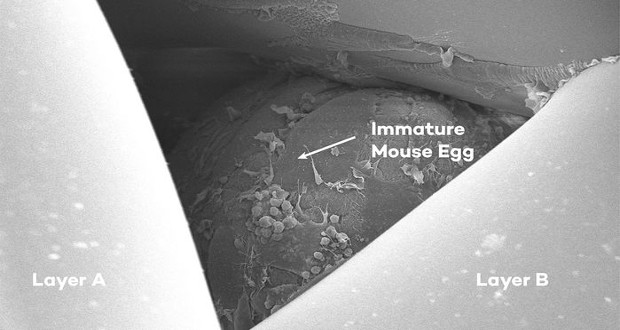 3D gedruckte Eierstöcke