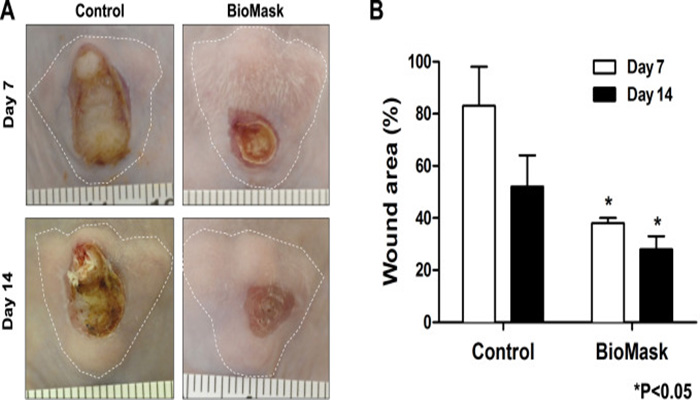 BioMask