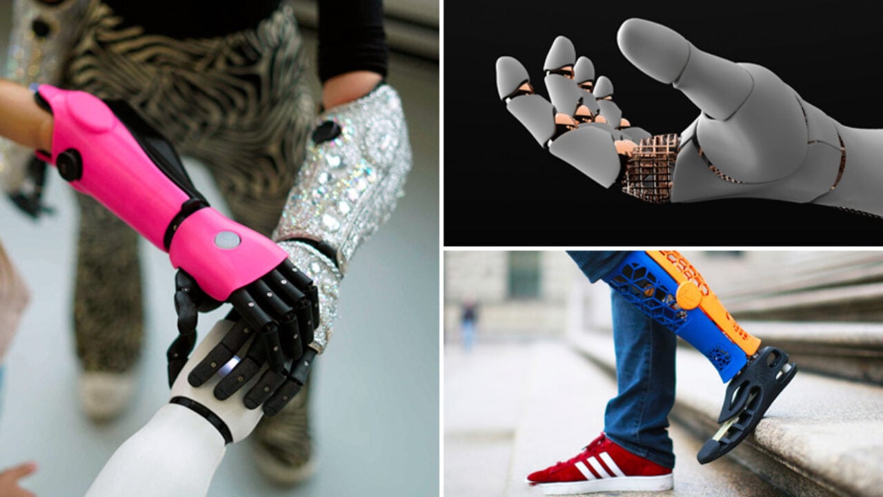 Top Examples of 3D Printed Prostheses - 3Dnatives