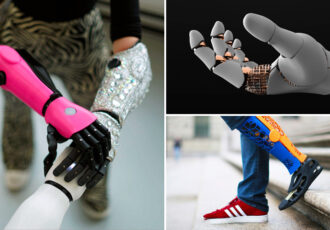 3D Prostheses