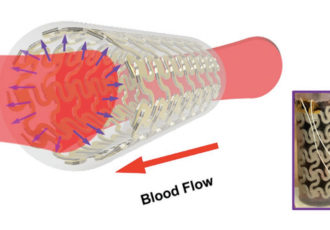 3d printed artery