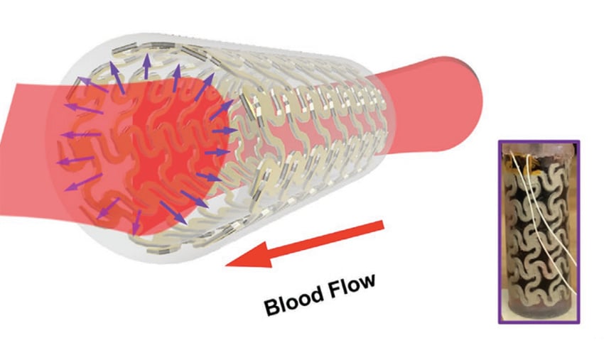 3d printed artery