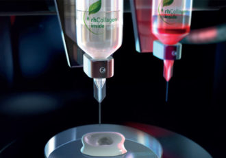 kidney bioprinting