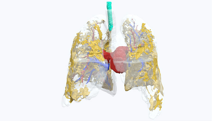 lung model