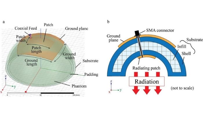 3D printing applications for breast cancer treatment