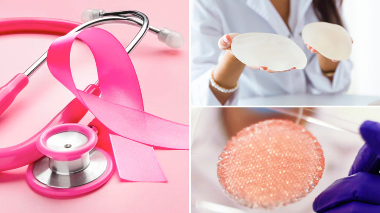 3D Printing Applications in the Fight Against Breast Cancer - 3Dnatives