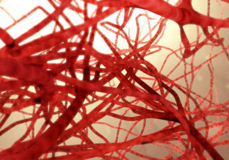 3D-printed blood vessels