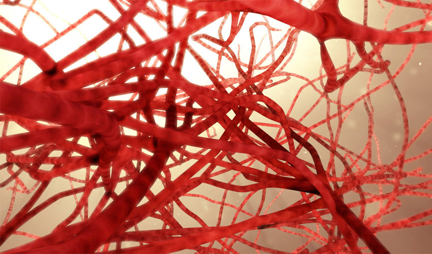 3D-printed blood vessels