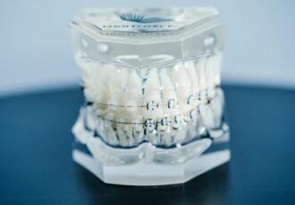 LightForce Orthodontics