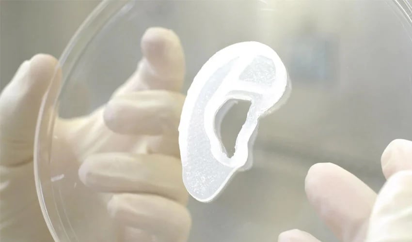 3D printed ear transplant