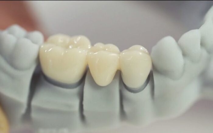 تصویر قوس دندانی پرینت سه بعدی