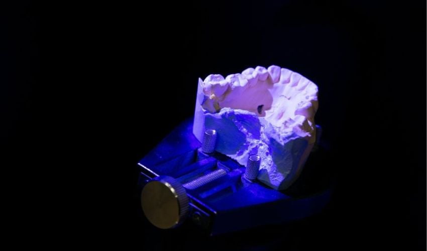 3D printing in dentistry report and the rise of beauty remedy