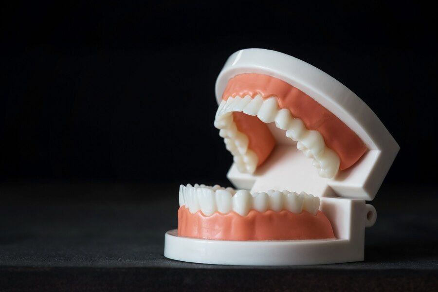 Anatomical model of the mouth