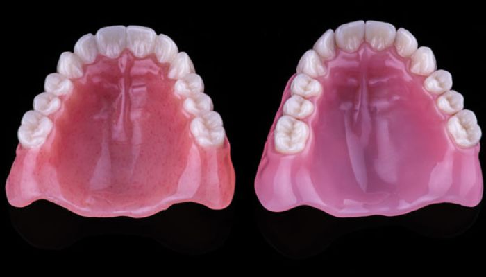 Comparison of dentures made by 3D printing and by milling