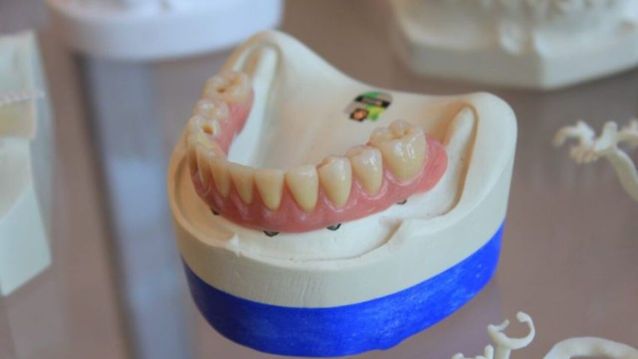 健康・医学 Best Denture Design High-Quality-and-Dental-Lab-