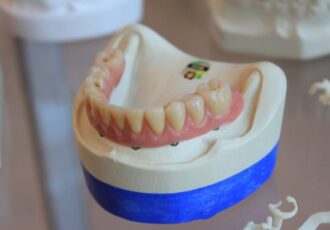 3D printed dentures for dentistry