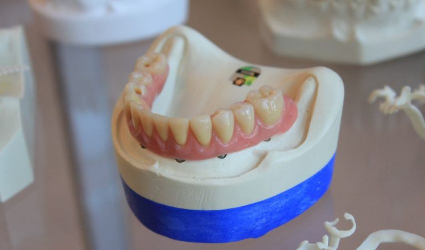 3D printed dentures for dentistry