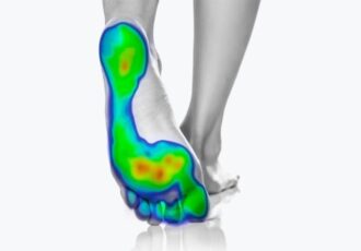 3D printed insoles