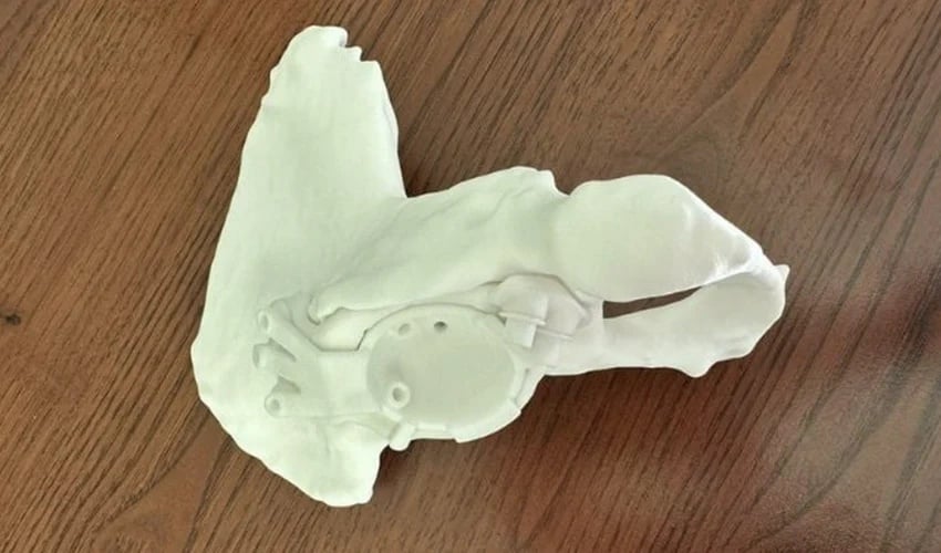 3D printed hip prosthesis