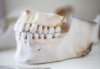 3D printing in a hospital in Mexico