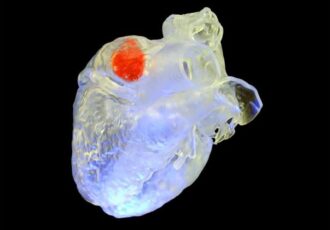 ultrasound 3D printing