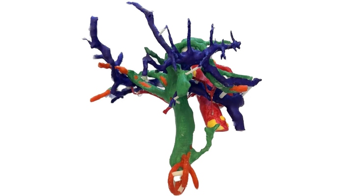 Modelos tumorales en 3D
