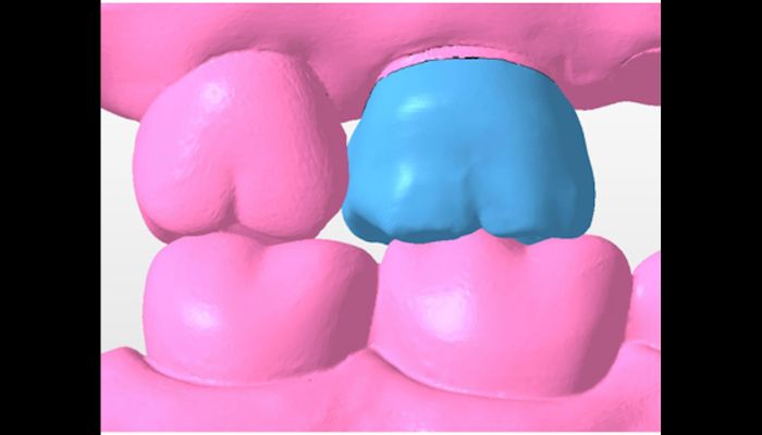 prosthodontiste