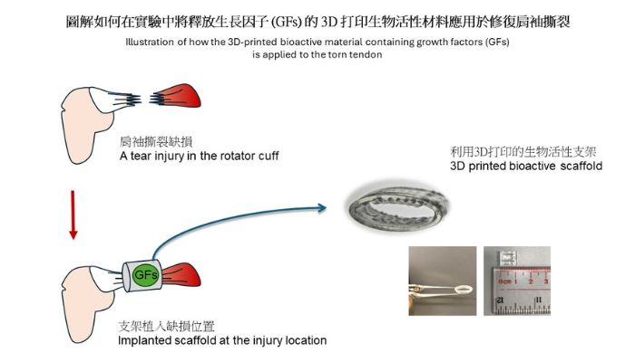 3D printing rotator cuff