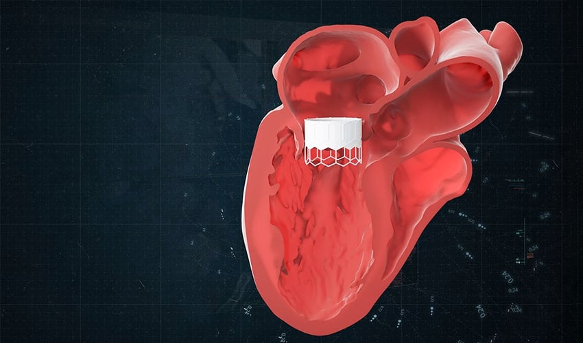 Materialise AI