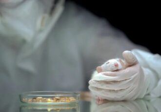 Organ-on-a-chip