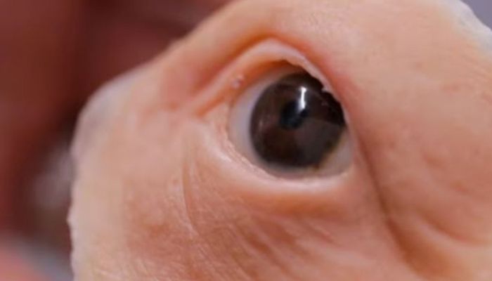 3D printing ophthalmology