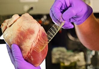a 3D printed band-aid for the heart