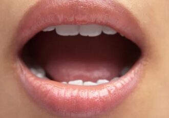 3D printed microfluidic device for oral cancer drug treatment screening