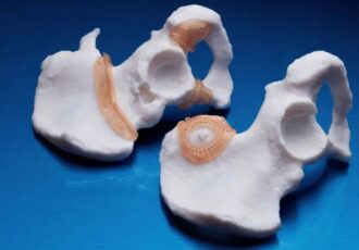 Ricoh and Insight Surgery's Surgical Guide
