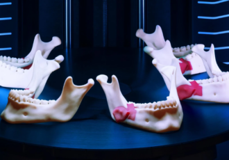 3D printing surgical planning