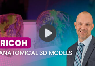 3D printed surgical guides for breast cancer treatment