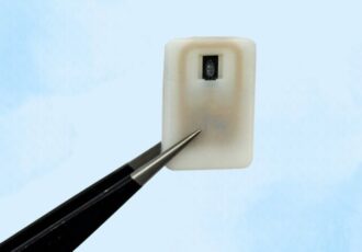 A new 3d printed implant
