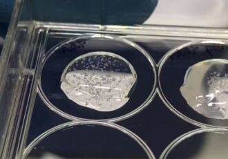 3d printed placenta