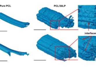 bioactive bone implants