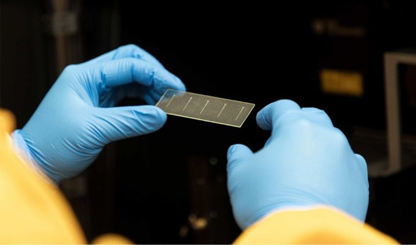 3d printing blood vessels strokes