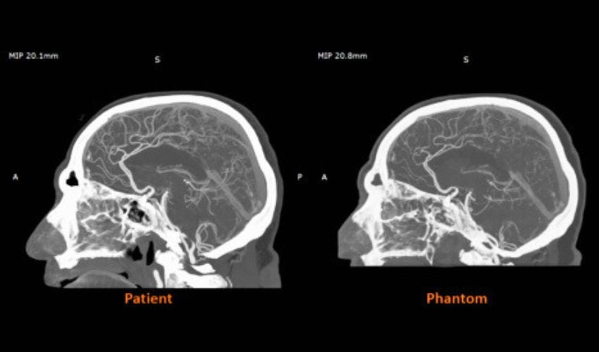 RadioMatrix™ 3D printed models